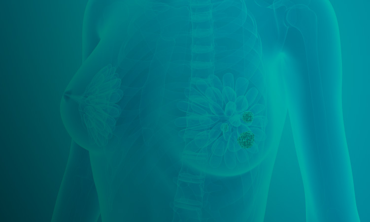 Jornada de Actualización en Cáncer de Mama